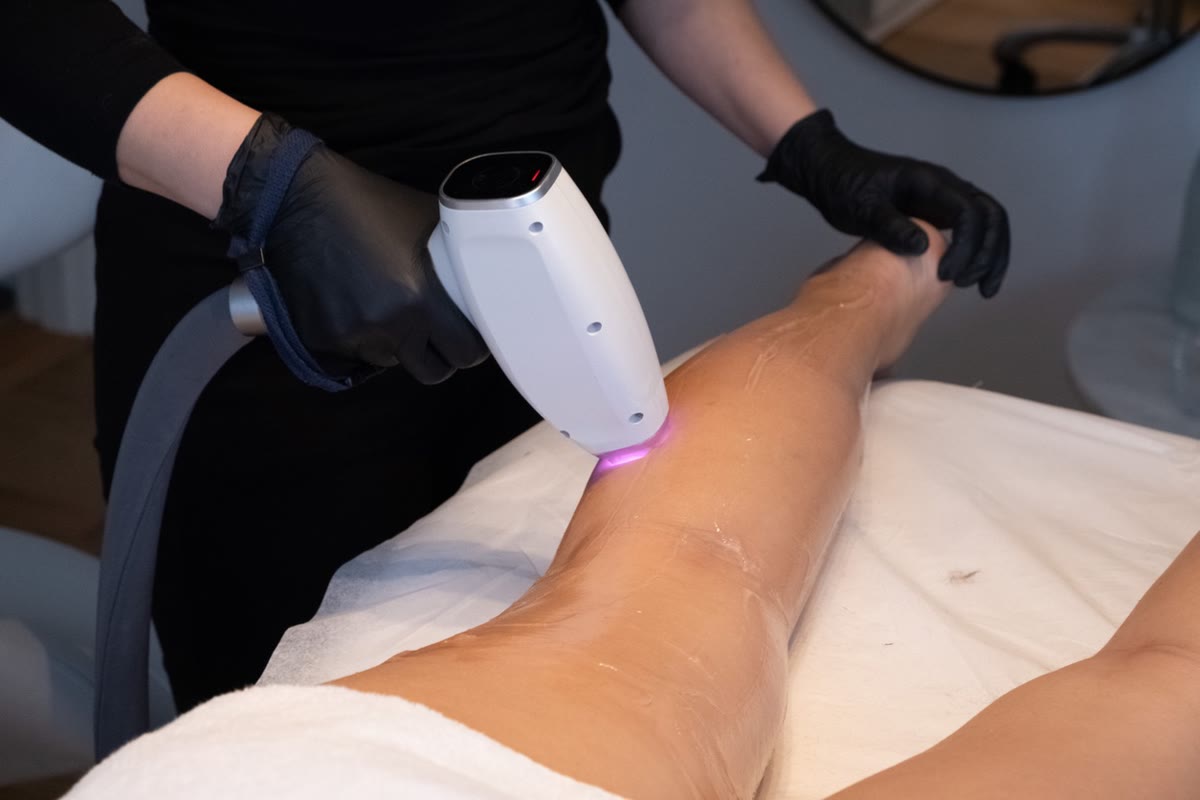 Laserhårborttagning med diodlaser hos KLINIK 17